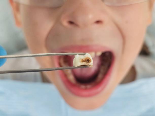 Best Emergency Care for Gum Disease in Wolf Trap, VA
